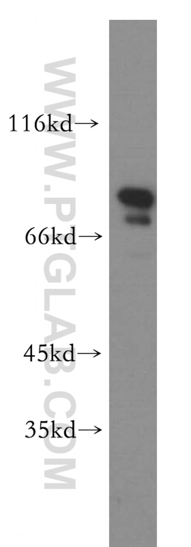 RMP Antibody in Western Blot (WB)