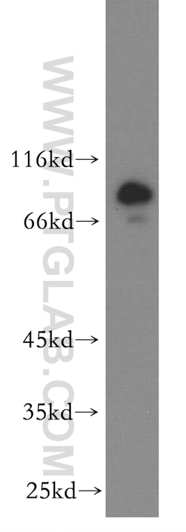 RMP Antibody in Western Blot (WB)