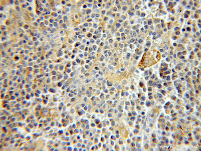 RMP Antibody in Immunohistochemistry (Paraffin) (IHC (P))