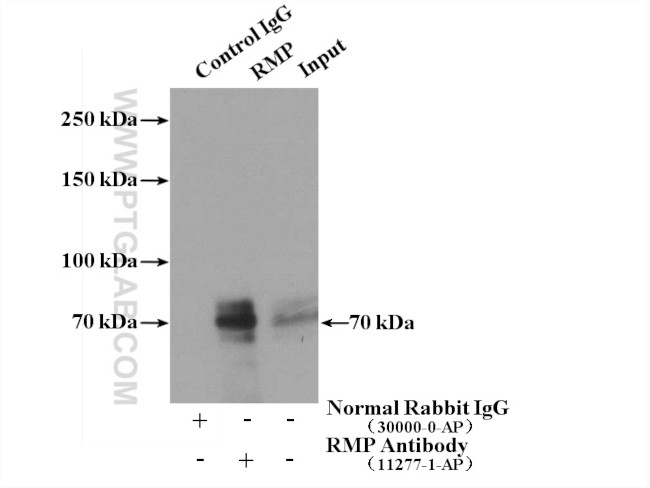 RMP Antibody in Immunoprecipitation (IP)