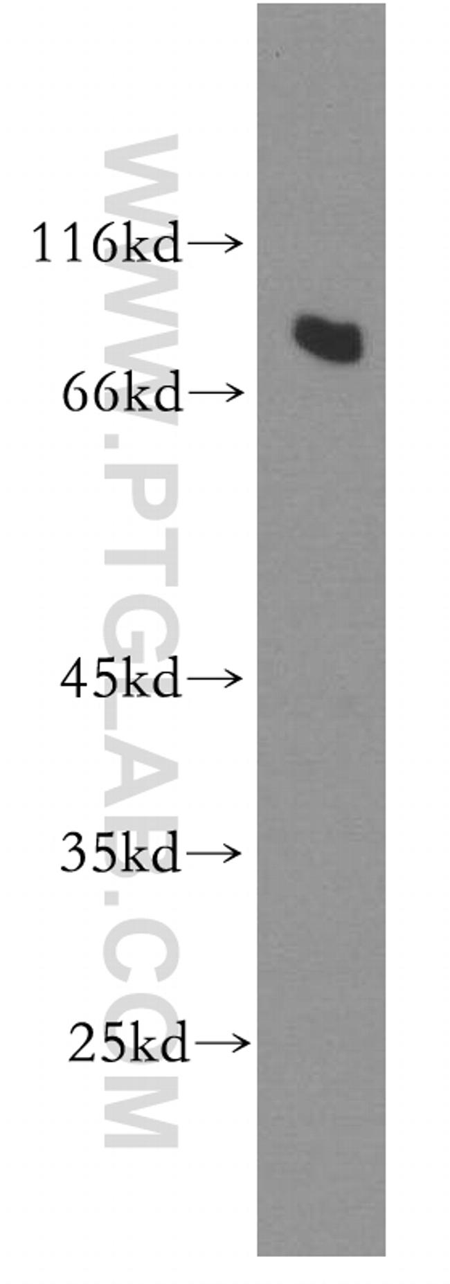 RMP Antibody in Western Blot (WB)