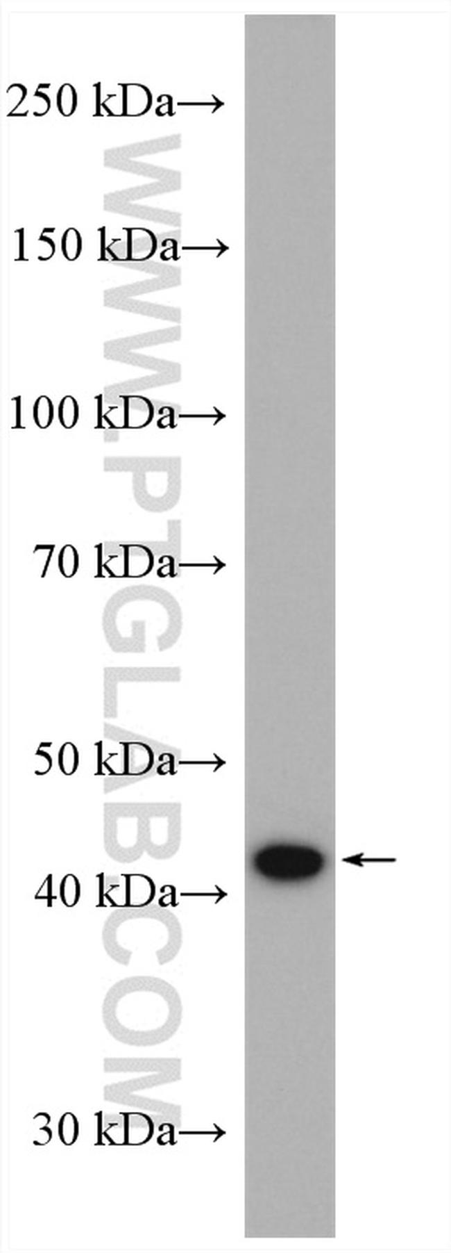 PRMT1 Antibody in Western Blot (WB)