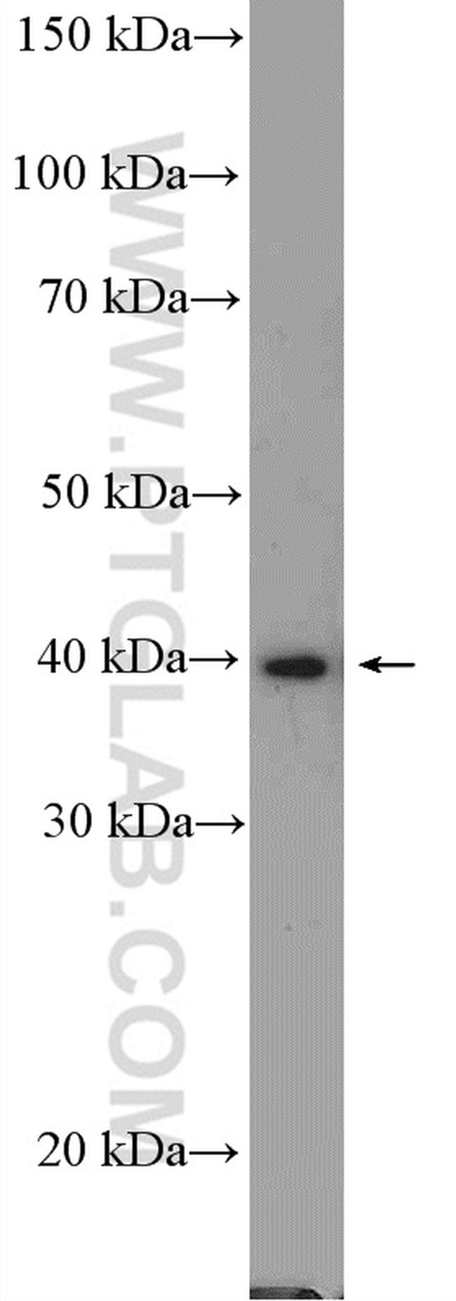 PRMT1 Antibody in Western Blot (WB)