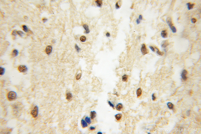 EIF4A2 Antibody in Immunohistochemistry (Paraffin) (IHC (P))