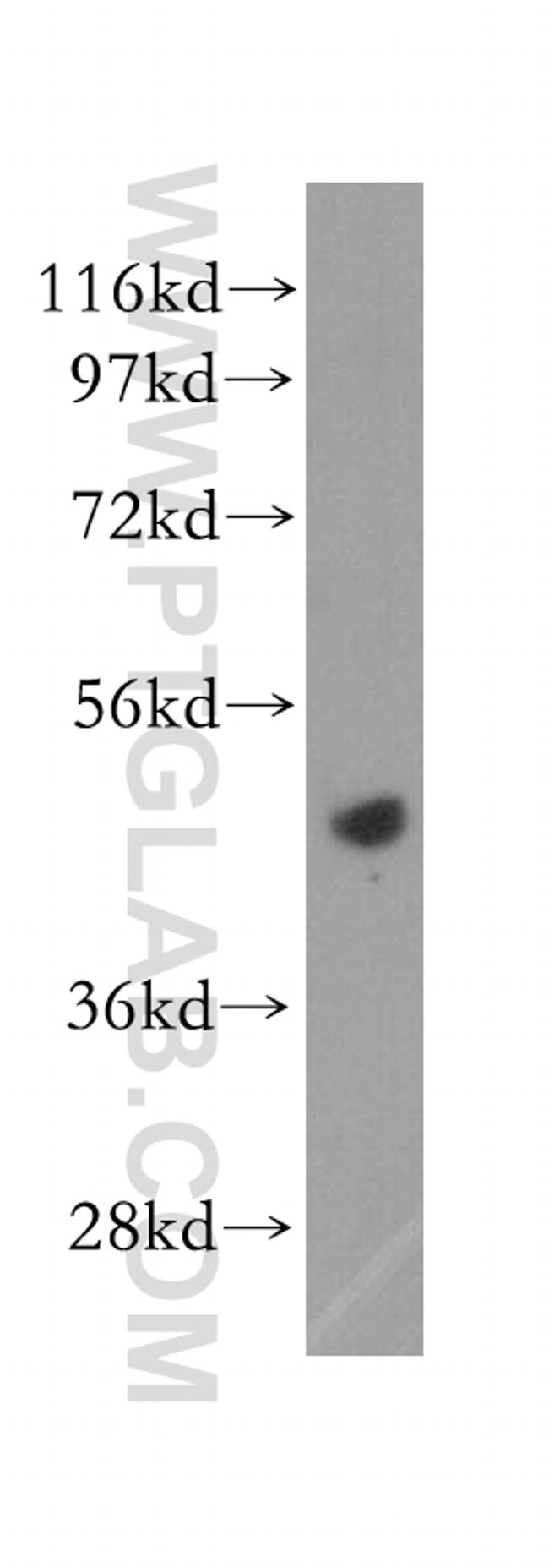 EIF4A2 Antibody in Western Blot (WB)