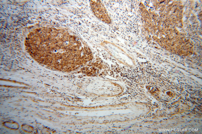 EIF4A2 Antibody in Immunohistochemistry (Paraffin) (IHC (P))