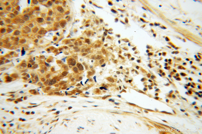 EIF4A2 Antibody in Immunohistochemistry (Paraffin) (IHC (P))