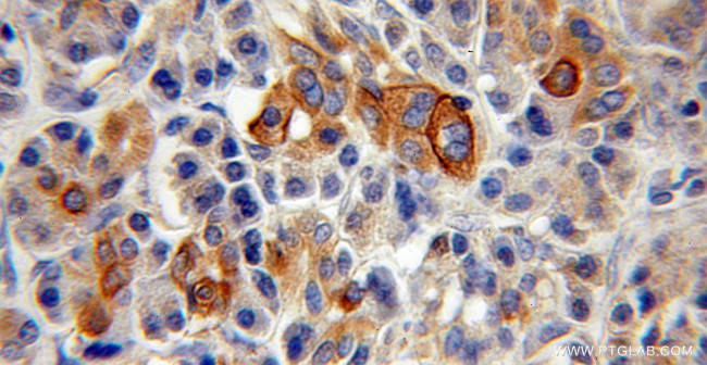 TMPRSS4 Antibody in Immunohistochemistry (Paraffin) (IHC (P))