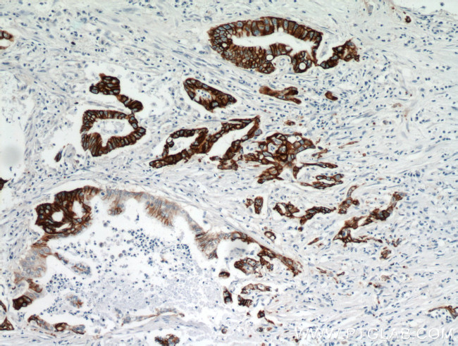 TMPRSS4 Antibody in Immunohistochemistry (Paraffin) (IHC (P))