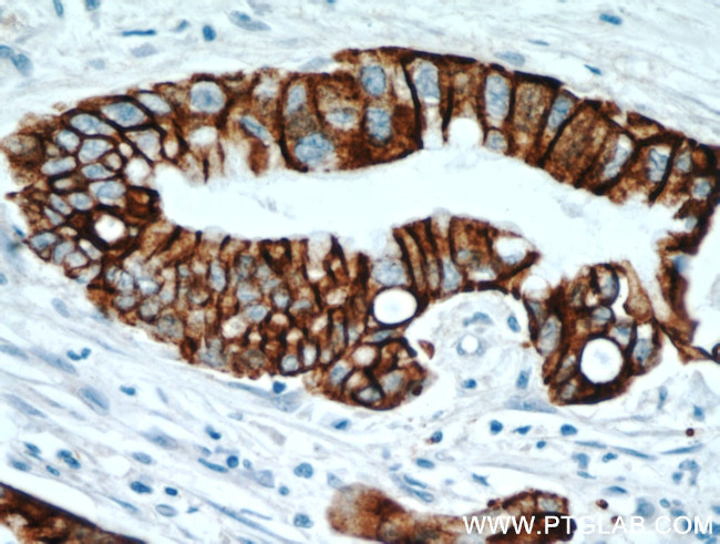 TMPRSS4 Antibody in Immunohistochemistry (Paraffin) (IHC (P))