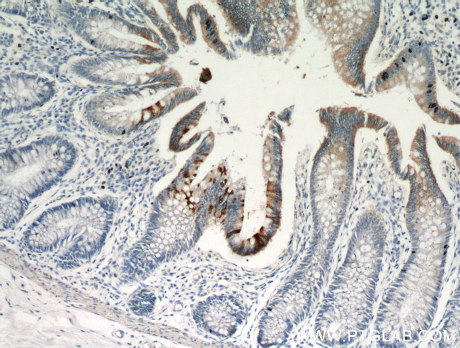 TMPRSS4 Antibody in Immunohistochemistry (Paraffin) (IHC (P))