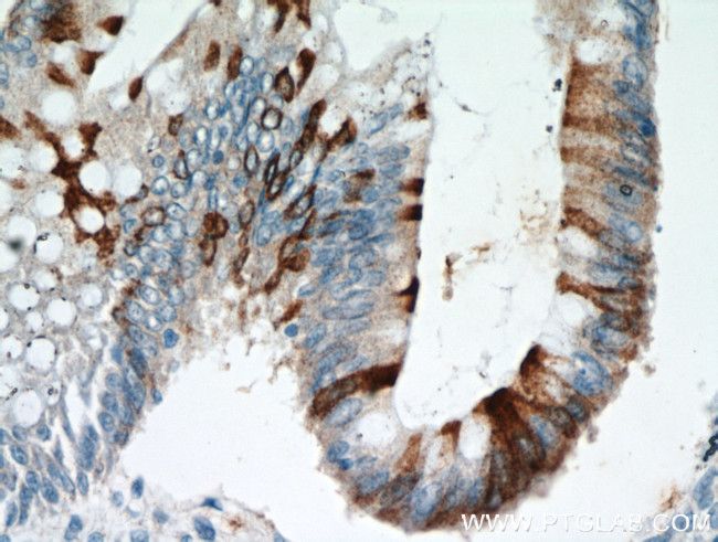 TMPRSS4 Antibody in Immunohistochemistry (Paraffin) (IHC (P))