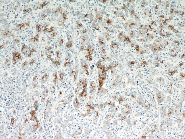 TMPRSS4 Antibody in Immunohistochemistry (Paraffin) (IHC (P))