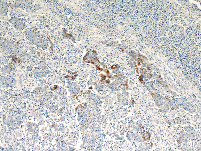 TMPRSS4 Antibody in Immunohistochemistry (Paraffin) (IHC (P))