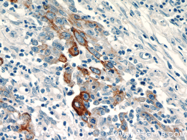 TMPRSS4 Antibody in Immunohistochemistry (Paraffin) (IHC (P))