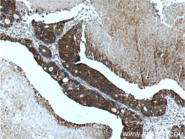 TMPRSS4 Antibody in Immunohistochemistry (Paraffin) (IHC (P))