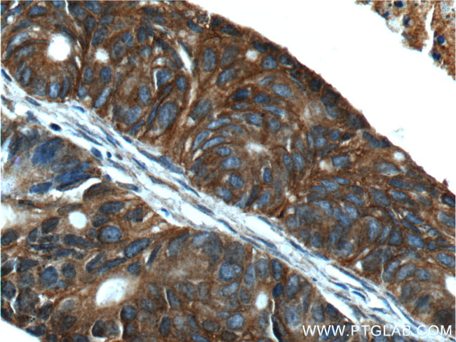 TMPRSS4 Antibody in Immunohistochemistry (Paraffin) (IHC (P))