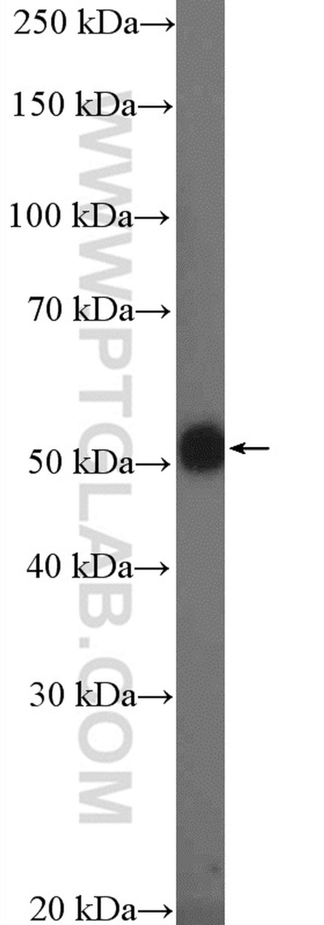 TMPRSS4 Antibody in Western Blot (WB)