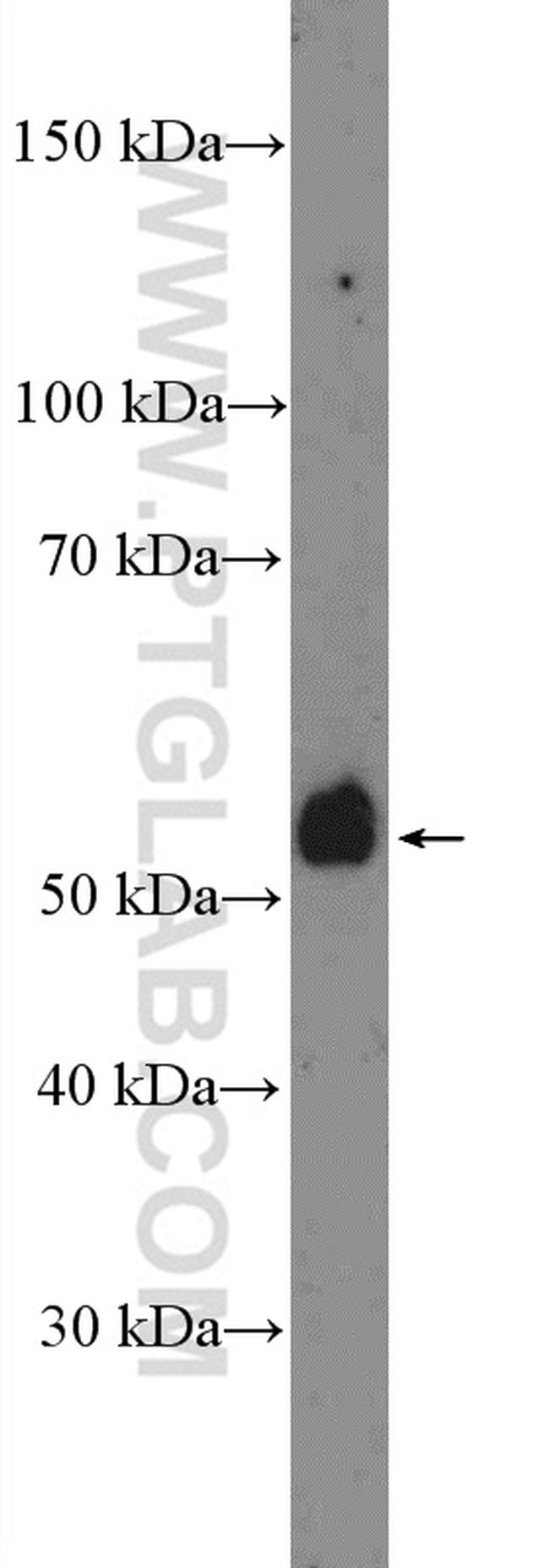 TMPRSS4 Antibody in Western Blot (WB)