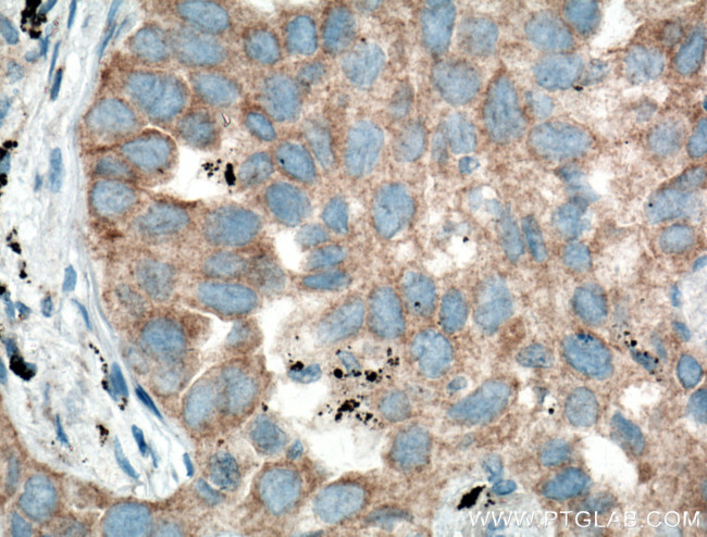 RNF156 Antibody in Immunohistochemistry (Paraffin) (IHC (P))