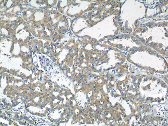 RNF156 Antibody in Immunohistochemistry (Paraffin) (IHC (P))