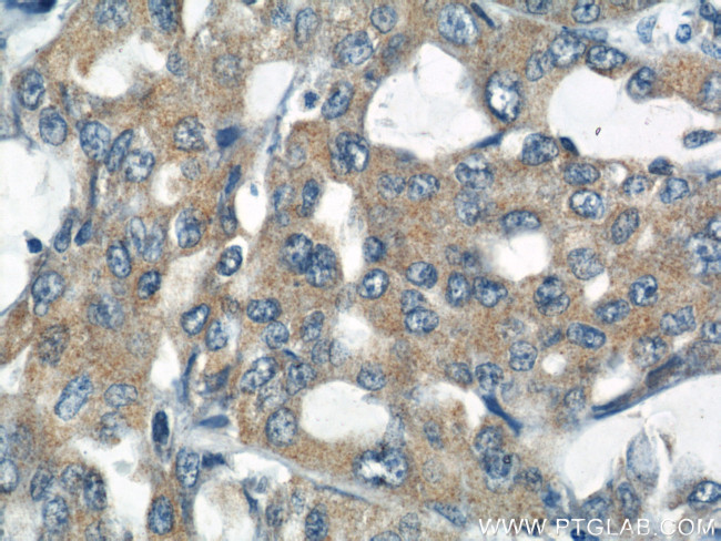 RNF156 Antibody in Immunohistochemistry (Paraffin) (IHC (P))