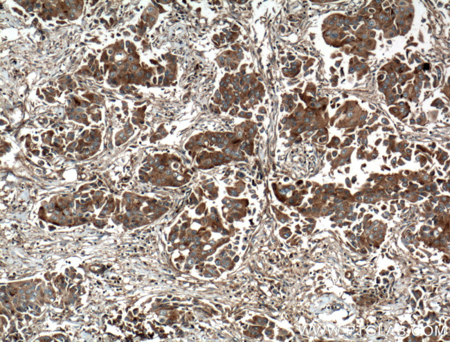 EIF3I Antibody in Immunohistochemistry (Paraffin) (IHC (P))