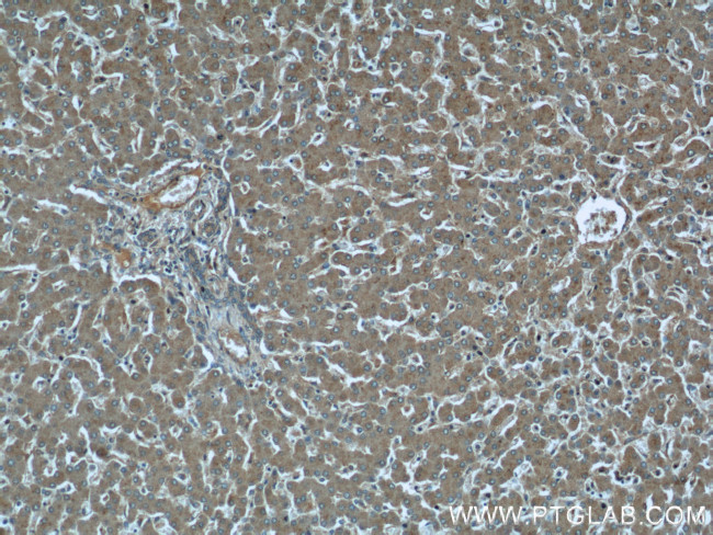 EIF3I Antibody in Immunohistochemistry (Paraffin) (IHC (P))