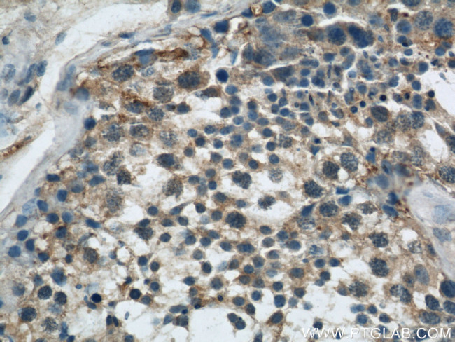 EIF3I Antibody in Immunohistochemistry (Paraffin) (IHC (P))