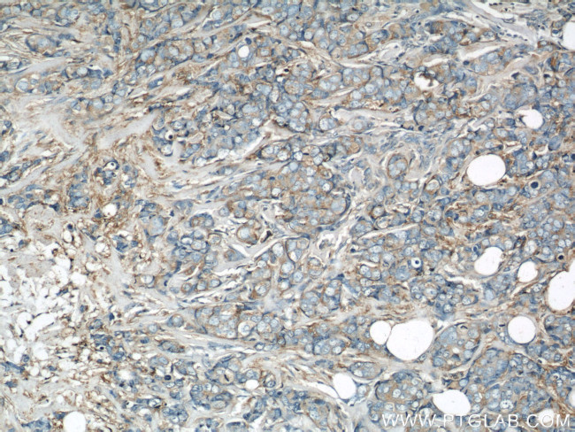 EIF3I Antibody in Immunohistochemistry (Paraffin) (IHC (P))