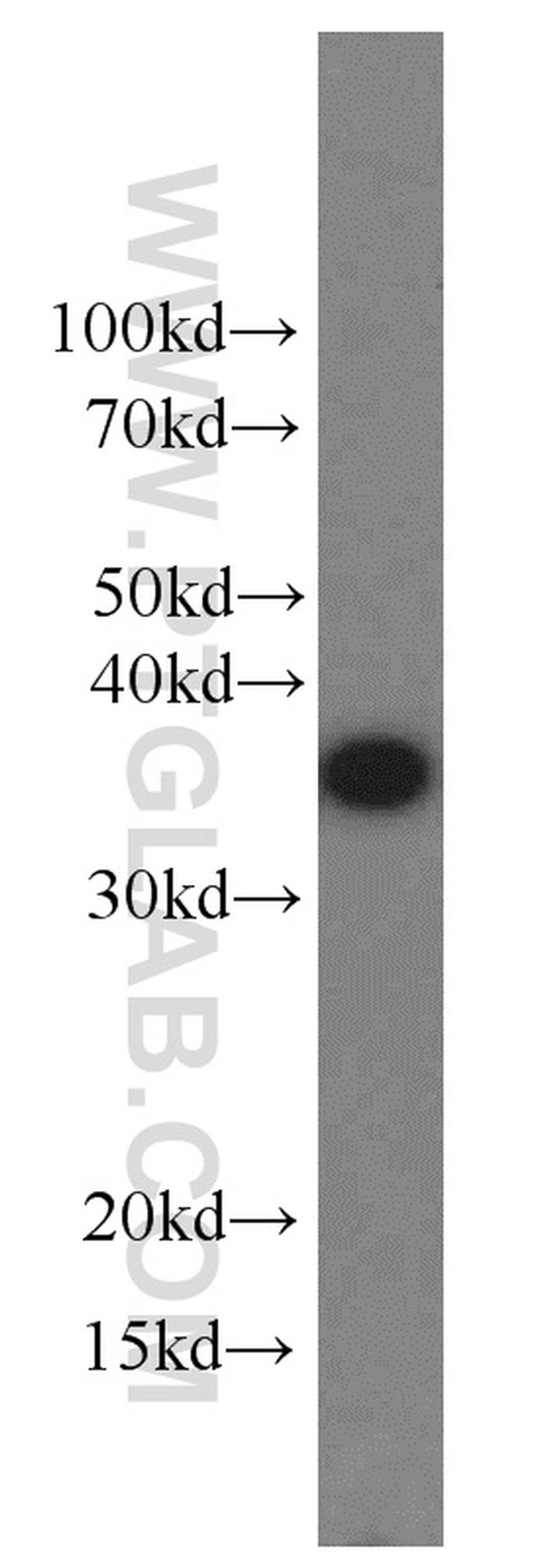 EIF3I Antibody in Western Blot (WB)