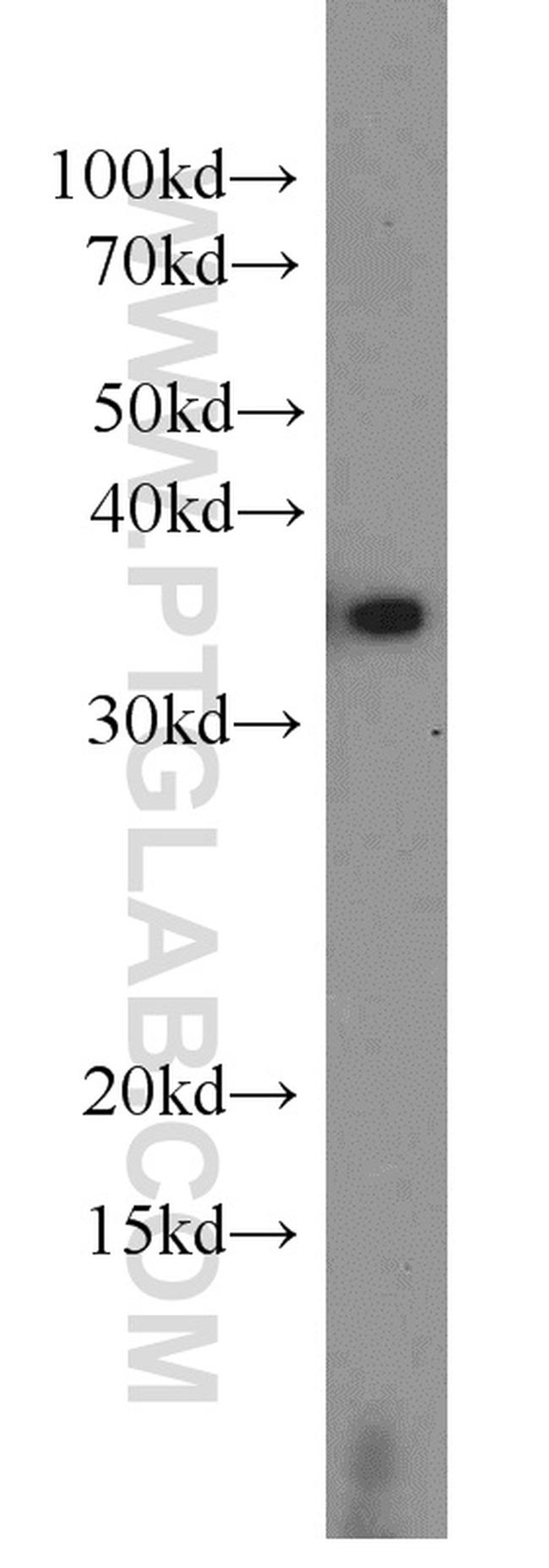 EIF3I Antibody in Western Blot (WB)