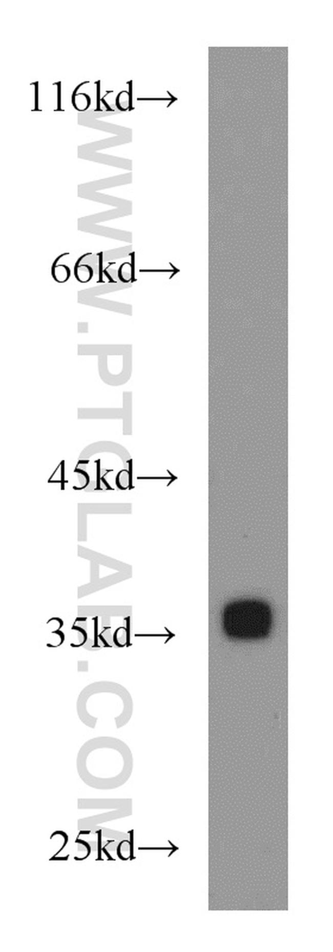 EIF3I Antibody in Western Blot (WB)