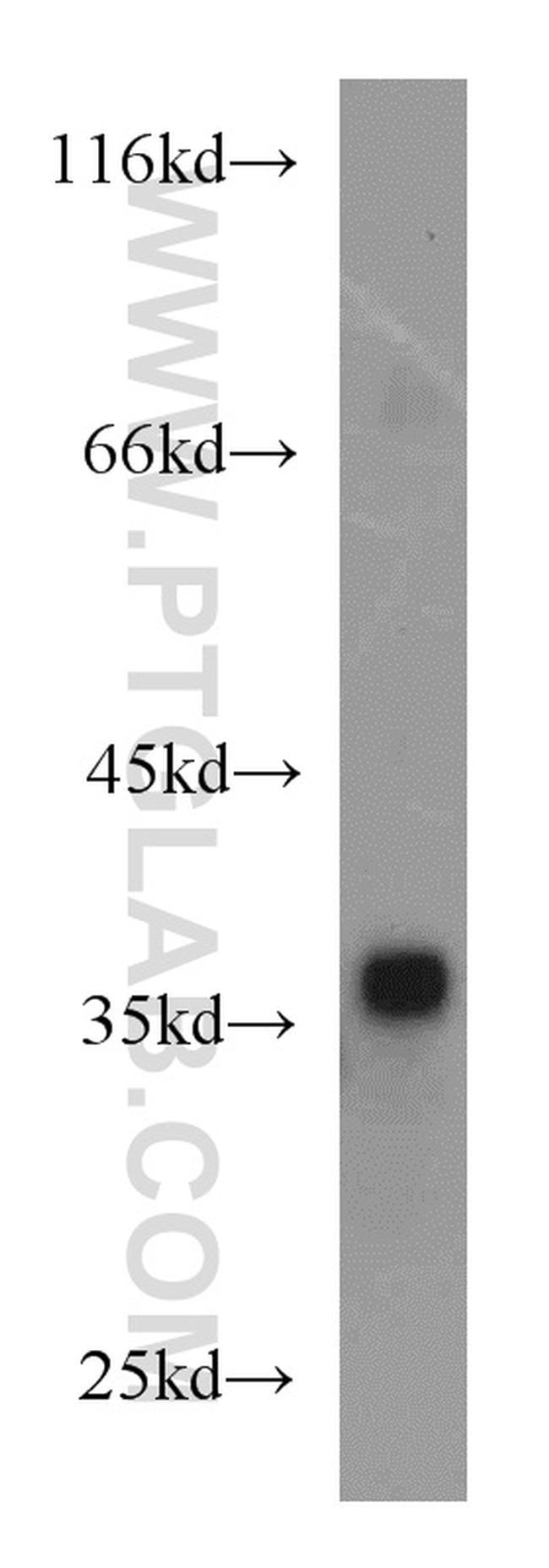 EIF3I Antibody in Western Blot (WB)