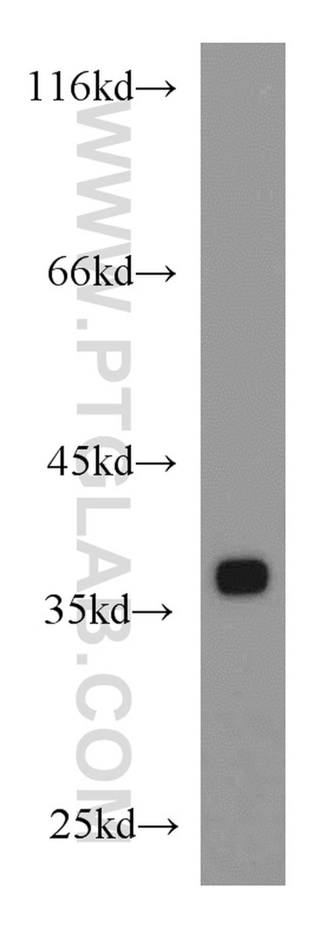 EIF3I Antibody in Western Blot (WB)