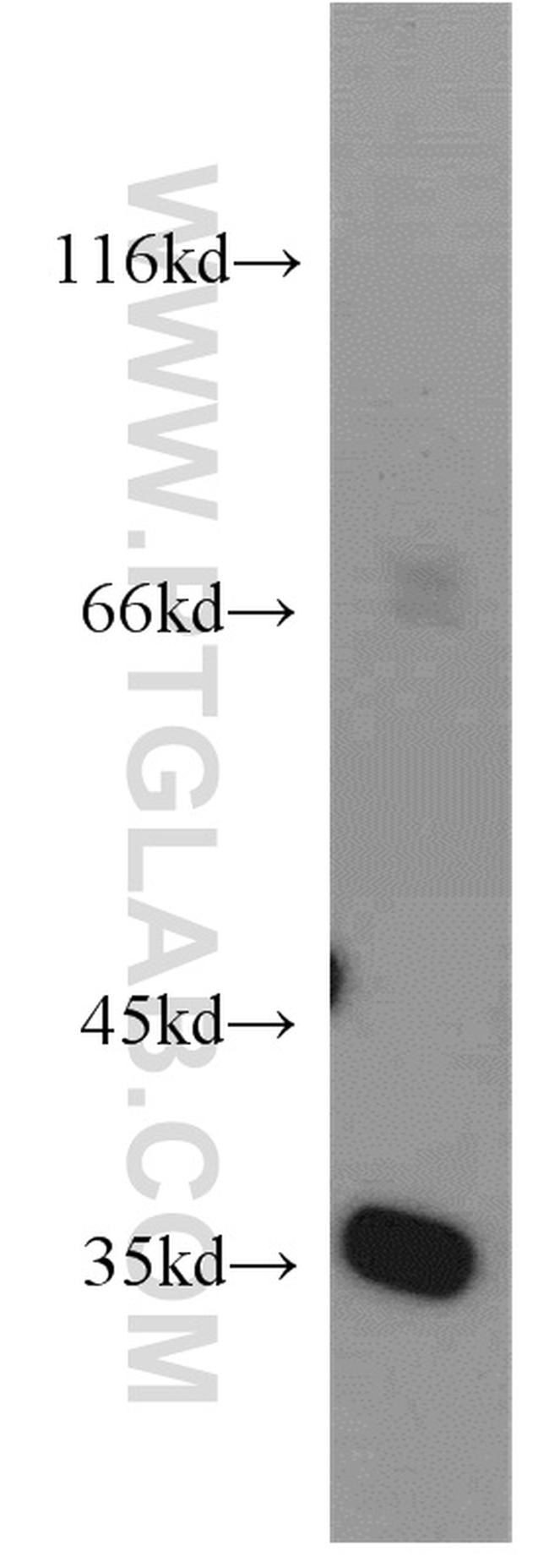 EIF3I Antibody in Western Blot (WB)