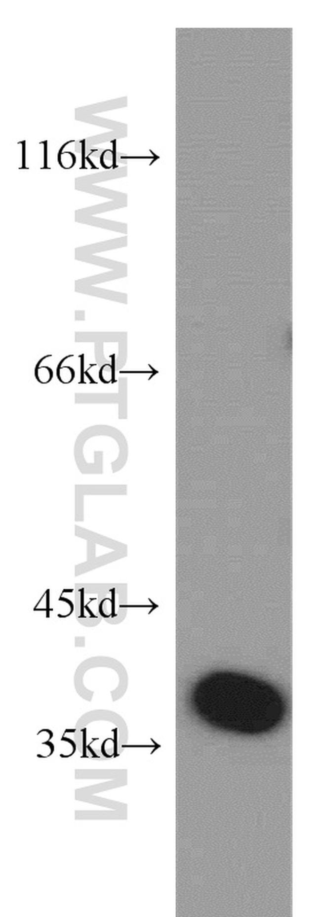 EIF3I Antibody in Western Blot (WB)