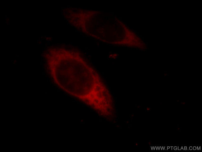 EIF3I Antibody in Immunocytochemistry (ICC/IF)