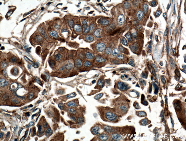 EIF3I Antibody in Immunohistochemistry (Paraffin) (IHC (P))