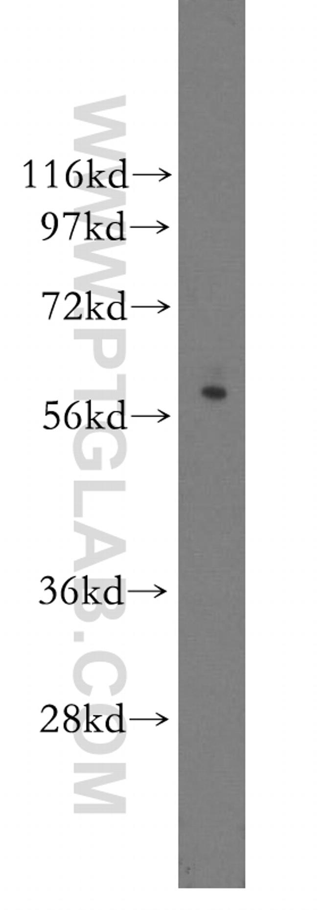 Granzyme A Antibody in Western Blot (WB)