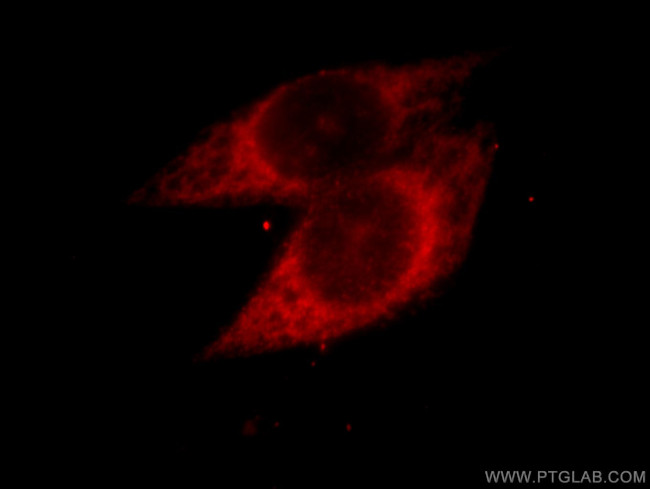 PARP3 Antibody in Immunocytochemistry (ICC/IF)