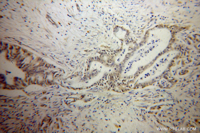 PARP3 Antibody in Immunohistochemistry (Paraffin) (IHC (P))