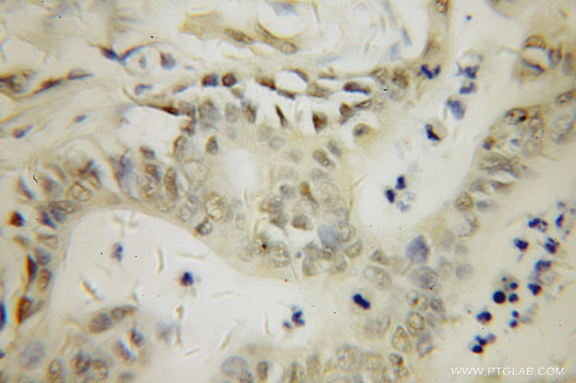 PARP3 Antibody in Immunohistochemistry (Paraffin) (IHC (P))