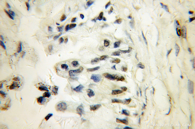 PARP3 Antibody in Immunohistochemistry (Paraffin) (IHC (P))