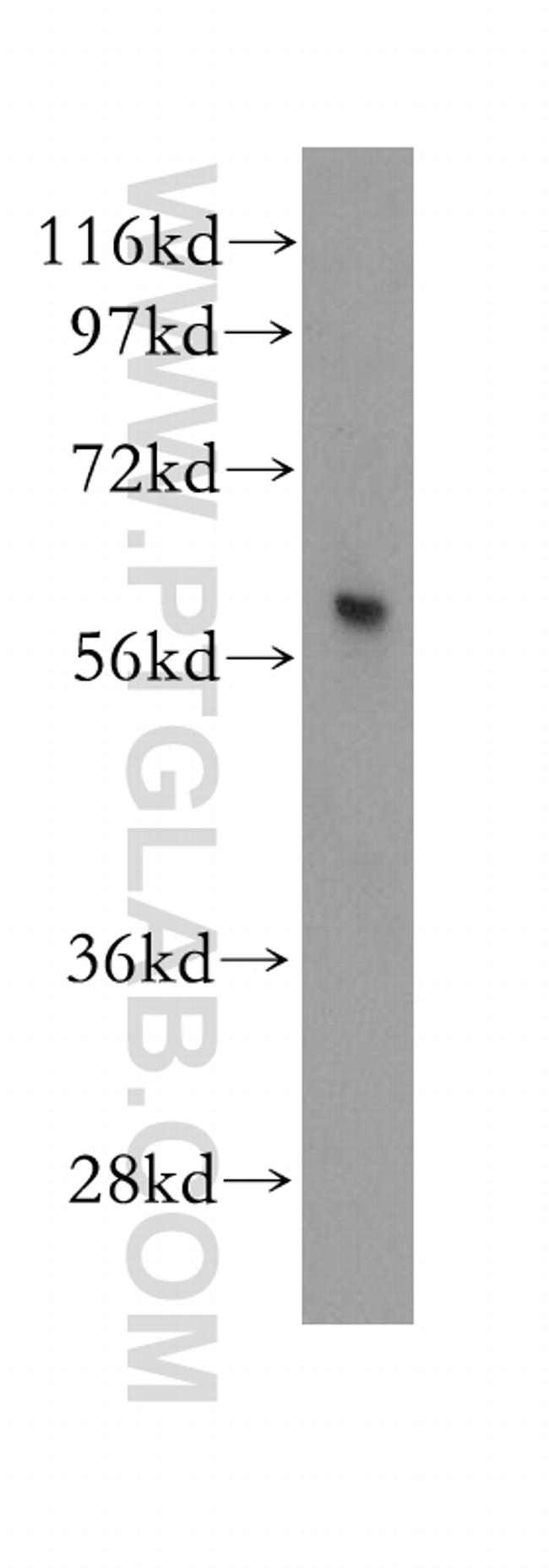 PARP3 Antibody in Western Blot (WB)