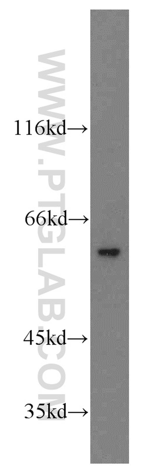 PARP3 Antibody in Western Blot (WB)