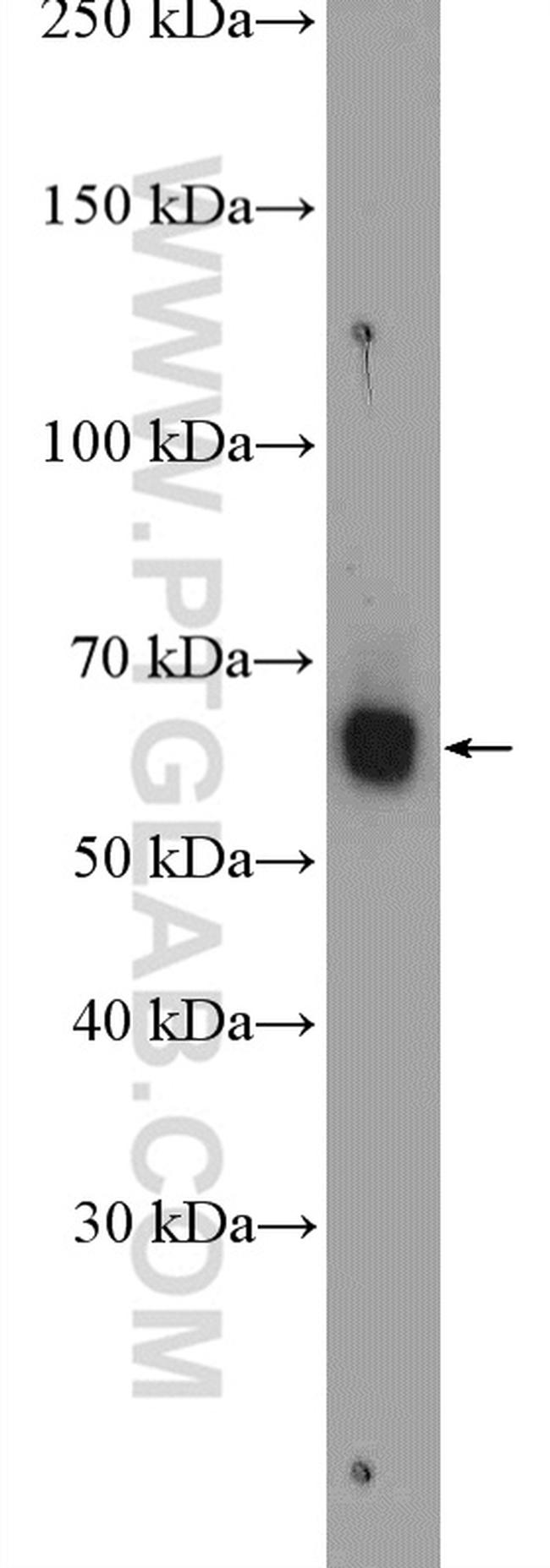 PARP3 Antibody in Western Blot (WB)