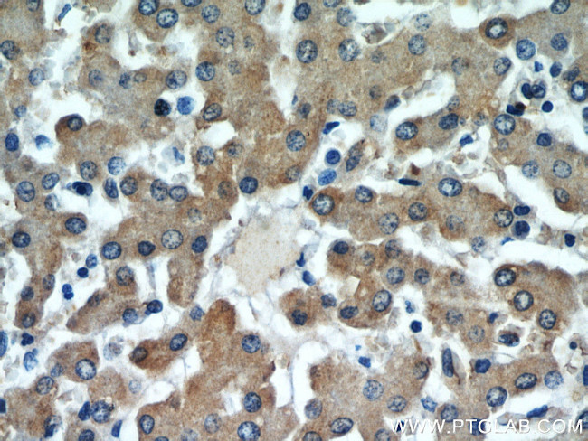 ALR Antibody in Immunohistochemistry (Paraffin) (IHC (P))