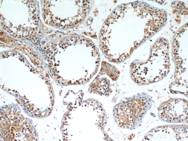 ALR Antibody in Immunohistochemistry (Paraffin) (IHC (P))