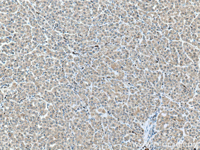 ALR Antibody in Immunohistochemistry (Paraffin) (IHC (P))